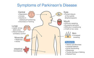 Symptoms of Parkinson’s Disease?