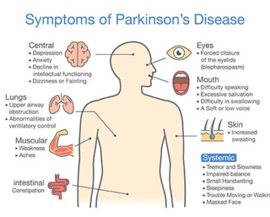 Symptoms of Parkinson’s Disease?