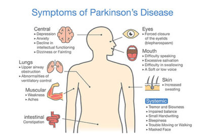 Symptoms of Parkinson’s Disease?