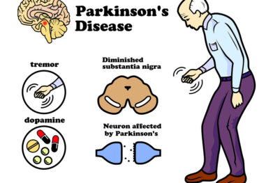 Parkinson’s Disease: Early Symptoms, Causes & Treatment