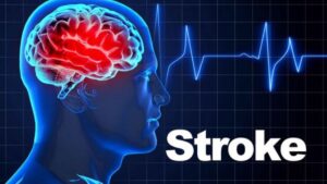 Dr.Sushma Sharma - Stroke Specialist in Faridabad