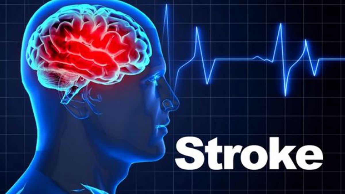 Dr.Sushma Sharma - Stroke Specialist in Faridabad